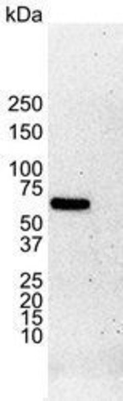 Invitrogen Estrogen Receptor alpha Monoclonal Antibody (6F11) 250 &mu;L;