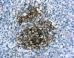 Invitrogen CD21 Monoclonal Antibody (1F8) 250 &mu;L; Unconjugated:Antibodies,