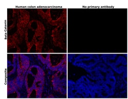 Invitrogen beta Catenin Monoclonal Antibody (6F9) 100 &mu;g; Unconjugated:Antibodies,