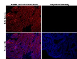 Invitrogen beta Catenin Monoclonal Antibody (6F9) 100 &mu;g; Unconjugated:Antibodies,