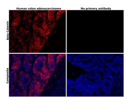 Invitrogen beta Catenin Monoclonal Antibody (6F9) 100 &mu;g; Unconjugated:Antibodies,