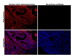 Invitrogen beta Catenin Monoclonal Antibody (6F9) 100 &mu;g; Unconjugated:Antibodies,