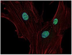 Invitrogen p21 Monoclonal Antibody (WA-1) 100 &mu;g | Buy Online | Invitrogen&trade; | Fisher Scientific