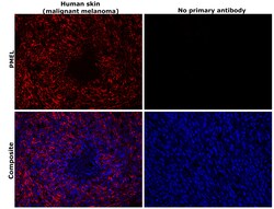 Invitrogen PMEL Monoclonal Antibody (HMB45) 500 &mu;L; Unconjugated:Antibodies,