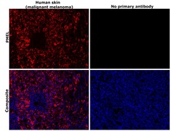 Invitrogen PMEL Monoclonal Antibody (HMB45) 500 &mu;L; Unconjugated:Antibodies,