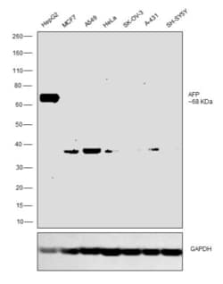 Invitrogen AFP Monoclonal Antibody (C2) 100 &mu;g | Buy Online | Invitrogen&trade; | Fisher Scientific