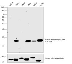 Invitrogen™ Mouse anti-Human Kappa Light Chain Secondary Antibody