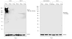 Invitrogen&trade;&nbsp;Mouse anti-Human Kappa Light Chain Secondary Antibody