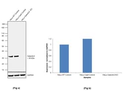 Invitrogen Galectin 3 Monoclonal Antibody (B2C10) 100 &mu;g; Unconjugated:Antibodies,
