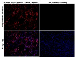 Invitrogen Progesterone Receptor Monoclonal Antibody (PR-AT 4.14) 100 &mu;g;
