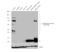 Invitrogen Progesterone Receptor Monoclonal Antibody (PR-AT 4.14) 100 &mu;g;