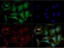 Invitrogen NOXA Monoclonal Antibody (114C307.1) 100 &mu;g; Unconjugated:Antibodies,