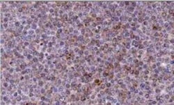 Invitrogen NOXA Monoclonal Antibody (114C307.1) 100 &mu;g; Unconjugated:Antibodies,