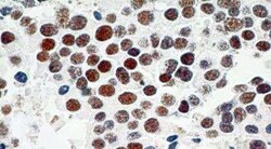 Invitrogen TRF2 Monoclonal Antibody (4A794.15) 100 &mu;g; Unconjugated:Anticuerpos