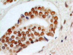 Invitrogen RAD9 Monoclonal Antibody (93A535) 100 &mu;g | Buy Online | Invitrogen&trade; | Fisher Scientific