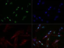 Invitrogen MYOD Monoclonal Antibody (5.8A) 100 &mu;g; Unconjugated:Antibodies,