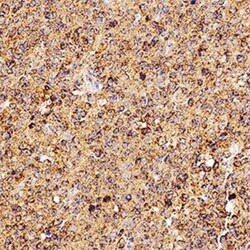 Invitrogen CD254 (RANK Ligand) Monoclonal Antibody (12A380) 100 &mu;g | Buy Online | Invitrogen&trade; | Fisher Scientific