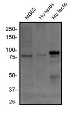 Invitrogen RANK Monoclonal Antibody (64C1385.1) 100 &mu;g | Buy Online | Invitrogen&trade; | Fisher Scientific