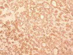 Invitrogen TEM8 Monoclonal Antibody (200C1339 (SB20)) 100 &mu;g; Unconjugated:Antibodies,