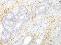 Invitrogen TEM8 Monoclonal Antibody (200C1339 (SB20)) 100 &mu;g | Buy Online | Invitrogen&trade; | Fisher Scientific