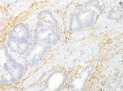 Invitrogen TEM8 Monoclonal Antibody (200C1339 (SB20)) 100 &mu;g; Unconjugated:Antibodies,