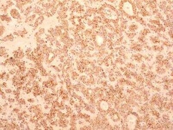 Invitrogen TEM8 Monoclonal Antibody (200C1339 (SB20)) 100 &mu;g | Buy Online | Invitrogen&trade; | Fisher Scientific