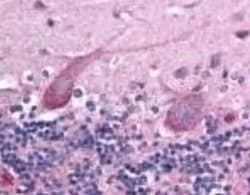 Invitrogen TEM7 Monoclonal Antibody (197C193 (IM193)) 100 &mu;g; Unconjugated:Antibodies,