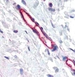 Invitrogen TEM7 Monoclonal Antibody (197C193 (IM193)) 100 &mu;g; Unconjugated:Antibodies,