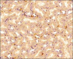 Invitrogen IL-25 Monoclonal Antibody (68C1039.2) 100 &mu;g | Buy Online | Invitrogen&trade; | Fisher Scientific