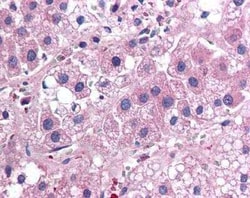 Invitrogen IL-25 Monoclonal Antibody (68C1039.2) 100 &mu;g | Buy Online | Invitrogen&trade; | Fisher Scientific