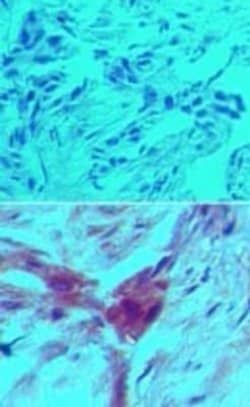 Invitrogen D4-GDI Monoclonal Antibody (97A1015) 100 &mu;g; Unconjugated:Antibodies,