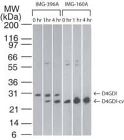 Invitrogen D4-GDI Monoclonal Antibody (97A1015) 100 &mu;g | Buy Online | Invitrogen&trade; | Fisher Scientific
