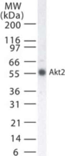Invitrogen AKT2 Monoclonal Antibody (95C657.1.2) 200 &mu;L; Unconjugated:Antibodies,
