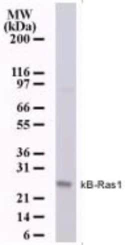 Invitrogen KappaB ras1 Monoclonal Antibody (184C278) 100 &mu;g; Unconjugated:Antibodies,