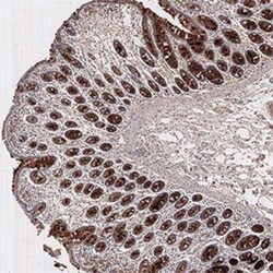 Invitrogen PMS2 Monoclonal Antibody (163C1251) 100 &mu;g | Buy Online | Invitrogen&trade; | Fisher Scientific