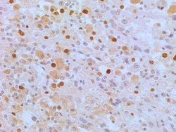 Invitrogen APIP Monoclonal Antibody (19F461) 100 &mu;g; Unconjugated:Antikörper