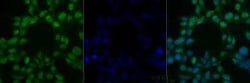 Invitrogen CHK2 Monoclonal Antibody (73C175.1.1) 100 &mu;g | Buy Online | Invitrogen&trade; | Fisher Scientific