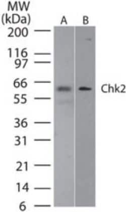 Invitrogen CHK2 Monoclonal Antibody (73C175.1.1) 100 &mu;g | Buy Online | Invitrogen&trade; | Fisher Scientific