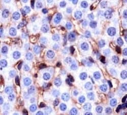 Invitrogen CD36 Monoclonal Antibody (D-2712) 100 &mu;L; Unconjugated:Antibodies,