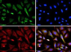Invitrogen CIP2A Monoclonal Antibody (2G10) 100 &mu;L | Buy Online | Invitrogen&trade; | Fisher Scientific