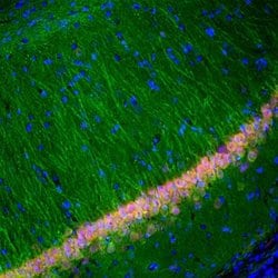 Invitrogen PGP9.5 Monoclonal Antibody (BH7) 100 &mu;L; Unconjugated:Antibodies,