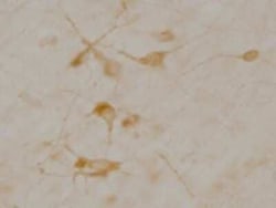 Invitrogen SLC5A7 Monoclonal Antibody (62-2E8) 100 &mu;L | Buy Online | Invitrogen&trade; | Fisher Scientific