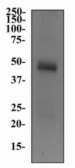 Invitrogen SLC5A7 Monoclonal Antibody (62-2E8) 100 &mu;L; Unconjugated:Antibodies,