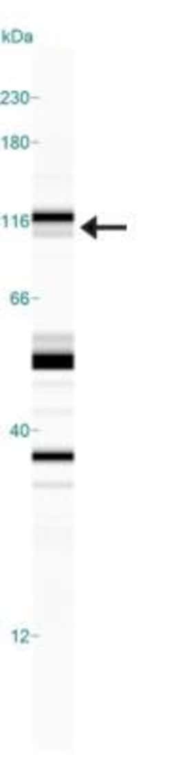 Invitrogen Phospho-NHE3 (Ser522) Monoclonal Antibody (14D5) 100 &mu;L;