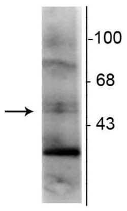 Invitrogen RXRG Monoclonal Antibody (1373) 100 &mu;L; Unconjugated:Antibodies,