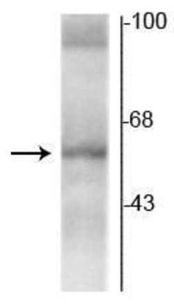 Invitrogen THRA Monoclonal Antibody (1330) 100 &mu;L; Unconjugated:Antibodies,