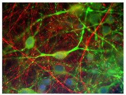 Invitrogen alpha Internexin Monoclonal Antibody (1D2) 100 &mu;L; Unconjugated:Antibodies,