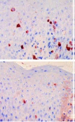 Invitrogen FceR1 alpha Monoclonal Antibody (CRA2 (AER24)) 100 &mu;g; Unconjugated:Antibodies,