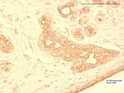 Invitrogen Cytokeratin Pan Type II Monoclonal Antibody (AE3) 200 &mu;L;