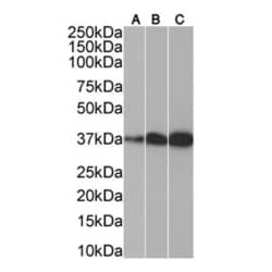 Invitrogen SMN1/SMN2 Monoclonal Antibody (2B1) 100 &mu;L; Unconjugated:Antibodies,